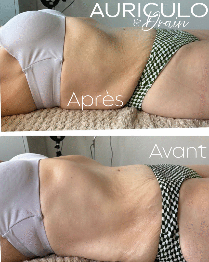 zones ciblées maderothérapie ventre fesses cuisses